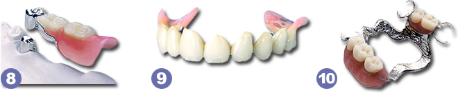 Herausnehmbarer Zahnersatz